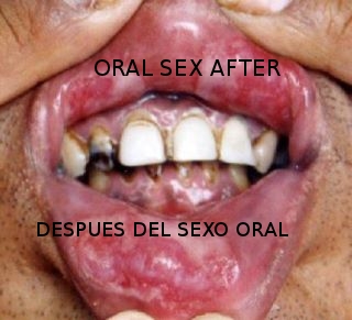 Los expertos explican cómo prevenir infecciones de transmisión sexual